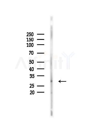 CA7 Antibody - Western blot analysis of lysates from Mouse testis, using CA7 Antibody at 1/1000 dilution.