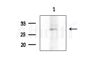CA11 Antibody - Western blot analysis of extracts from COLO205 cells, using CA11 Antibody at 1/1000 dilution.