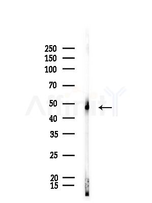 CPA4 Antibody - Western blot analysis of lysates from Rat brain, using CPA4 Antibody at 1/1000 dilution.