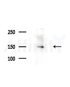 CPD Antibody - Western blot analysis of extracts from Rat brain, using CPD Antibody at 1/1000 dilution.
