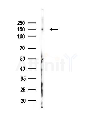 CPD Antibody - Western blot analysis of lysates from Rat brain, using CPD Antibody at 1/1000 dilution.