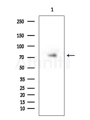 CPXM2 Antibody - Western blot analysis of extracts from PC12 cells(LPS 4h treatment), using CPXM2 Antibody at 1/1000 dilution.