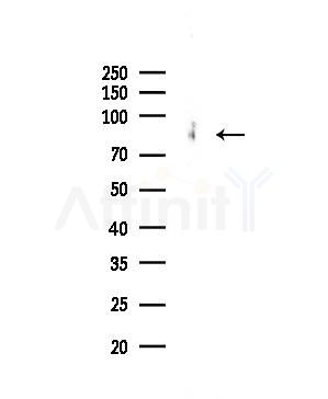CPXM2 Antibody - Western blot analysis of lysates from PC12 cells(LPS 4h treatment), using CPXM2 Antibody at 1/1000 dilution.