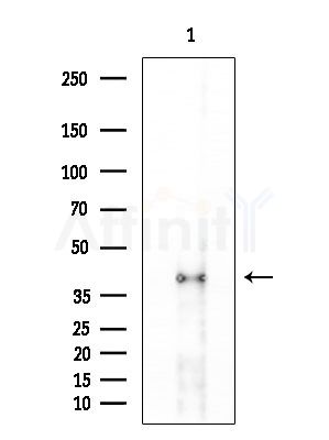 CEACAM16 Antibody - Western blot analysis of extracts from PC12 cells(LPS 4h treatment), using CEACAM16 Antibody at 1/1000 dilution.
