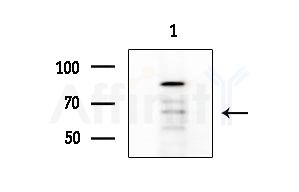 CEACAM20 Antibody - Western blot analysis of extracts from COLO205 cells, using CEACAM20 Antibody at 1/1000 dilution.