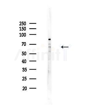 CEACAM20 Antibody - Western blot analysis of lysates from COLO205 cells, using CEACAM20 Antibody at 1/1000 dilution.