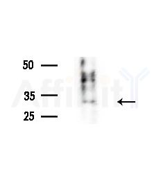 CEACAM7 Antibody - Western blot analysis of extracts from B16F10-LUC cells(LPS,4h treatment), using CEACAM7 Antibody at 1/1000 dilution.