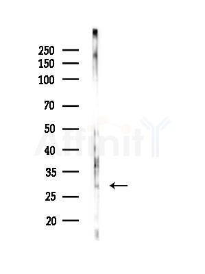 CEACAM7 Antibody - Western blot analysis of lysates from B16F10-LUC cells(LPS,4h treatment), using CEACAM7 Antibody at 1/1000 dilution.