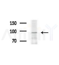 CTNNA2 Antibody - Western blot analysis of extracts from various samples, using CTNNA2 Antibody at 1/1000 dilution.
