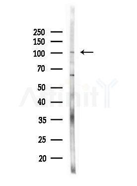 CTNNA2 Antibody - Western blot analysis of lysates from PC12 cells(LPS, 4h treatment), using CTNNA2 Antibody at 1/1000 dilution.
