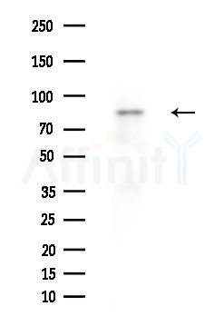 CATSPER1 Antibody - Western blot analysis of extracts from A375 cells(heat-shock treatment), using CATSPER1 Antibody at 1/1000 dilution.