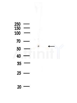 CATSPER4 Antibody - Western blot analysis of lysates from HUVEC cells, using CATSPER4 Antibody at 1/1000 dilution.