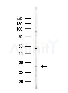 CHAC1 Antibody - Western blot analysis of lysates from HepG2 cells(LPS,4h treatment), using CHAC1 Antibody at 1/1000 dilution.