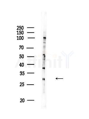 M6PR Antibody - Western blot analysis of lysates from HUVEC cells, using M6PR Antibody at 1/1000 dilution.