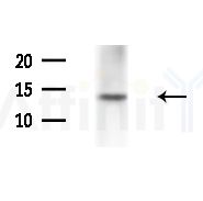 CRABP1 Antibody - Western blot analysis of extracts from Mouse testis, using CRABP1 Antibody at 1/1000 dilution.