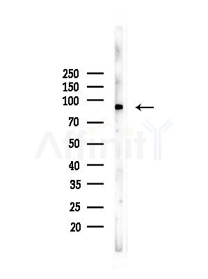 ACAP2 Antibody - Western blot analysis of lysates from PC12 cells(LPS, 4h treatment), using ACAP2 Antibody at 1/1000 dilution.