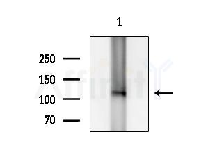 CEP110 Antibody - Western blot analysis of extracts from HUVEC cells, using CEP110 Antibody at 1/1000 dilution.