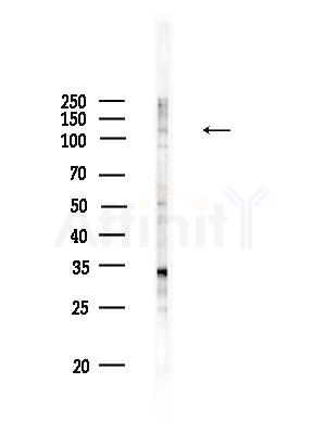 CEP110 Antibody - Western blot analysis of lysates from HUVEC cells, using CEP110 Antibody at 1/1000 dilution.