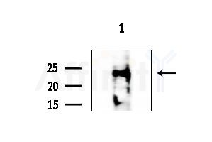 CEP27 Antibody - Western blot analysis of extracts from HepG2 cells(LPS 4h treatment), using CEP27 Antibody at 1/1000 dilution.