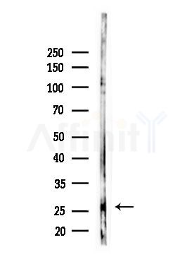 CEP27 Antibody - Western blot analysis of lysates from HepG2 cells(LPS,4h treatment), using CEP27 Antibody at 1/1000 dilution.