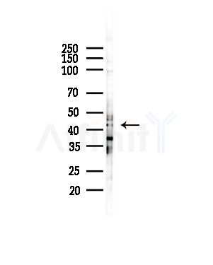 CEP41 Antibody - Western blot analysis of lysates from COLO205 cells(heat-shock,45min treatment), using CEP41 Antibody at 1/1000 dilution.