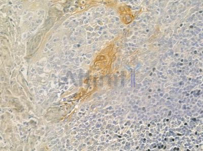 CEP41 Antibody - DF9362 at 1/100 staining human normal tonsil tissue by IHC-P.