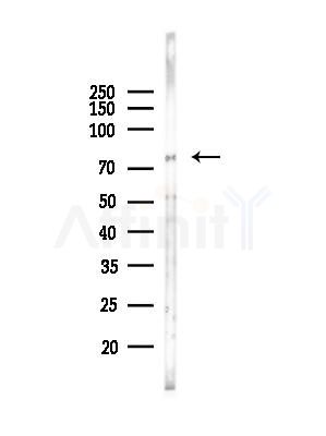 CEP63 Antibody - Western blot analysis of lysates from EC304 cells(heat-shock,45min treatment), using CEP63 Antibody at 1/1000 dilution.