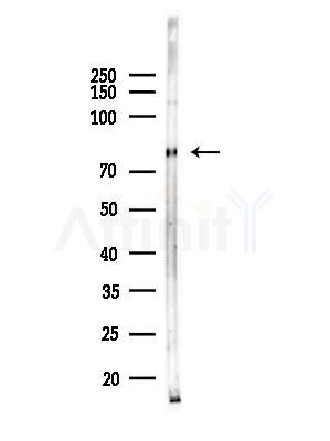 CEP63 Antibody - Western blot analysis of lysates from PC12 cells(LPS, 4h treatment), using CEP63 Antibody at 1/1000 dilution.