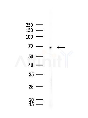 CEP72 Antibody - Western blot analysis of lysates from Rat brain, using CEP72 Antibody at 1/1000 dilution.