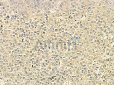 CEP72 Antibody - DF9365 at 1/100 staining human pituitary adenoma by IHC-P.