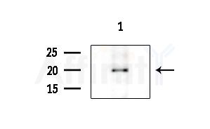CKLF Antibody - Western blot analysis of extracts from HepG2 cells(LPS 4h treatment), using CKLF Antibody at 1/1000 dilution.