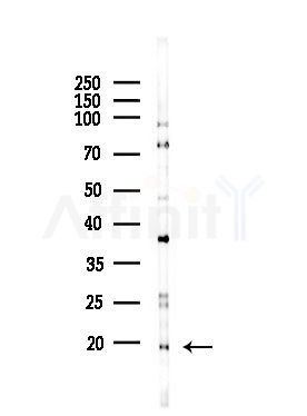 CKLF Antibody - Western blot analysis of lysates from HepG2 cells(LPS,4h treatment), using CKLF Antibody at 1/1000 dilution.