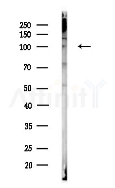 CLCN2 Antibody - Western blot analysis of lysates from PC12 cells, using CLCN2 Antibody at 1/1000 dilution.