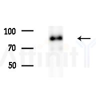 CLCNKB Antibody - Western blot analysis of lysates from MDA-MB-231 cells(heat-shock,45min treatment), using CLCNKB Antibody at 1/1000 dilution.