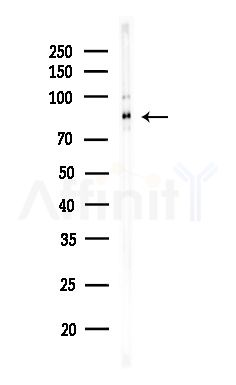 CLCNKB Antibody - Western blot analysis of lysates from MDA-MB-231 cells(heat-shock,45min treatment), using CLCNKB Antibody at 1/1000 dilution.