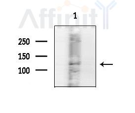 CLCN1 Antibody - Western blot analysis of extracts from Rat brain, using CLCN1 Antibody at 1/1000 dilution.