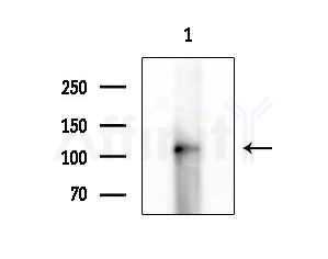 CLCN1 Antibody - Western blot analysis of extracts from HUVEC cells, using CLCN1 Antibody at 1/1000 dilution.