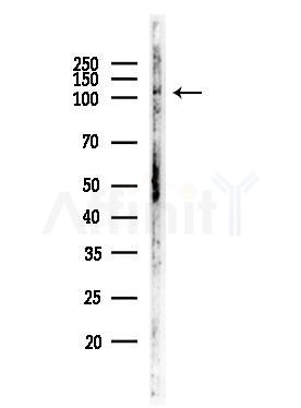 CLCN1 Antibody - Western blot analysis of lysates from Rat brain, using CLCN1 Antibody at 1/1000 dilution.