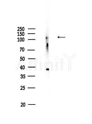 CLCN1 Antibody - Western blot analysis of lysates from HUVEC cells, using CLCN1 Antibody at 1/1000 dilution.