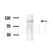 CHSY3 Antibody - Western blot analysis of extracts from MDA-MB-231 cells(heat-shock,45min treatment), using CHSY3 Antibody at 1/1000 dilution.
