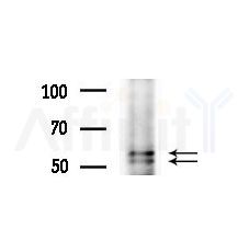 CBX2 Antibody - Western blot analysis of extracts from various samples, using CBX2 Antibody at 1/1000 dilution.
