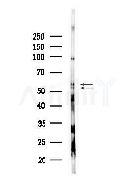 CBX2 Antibody - Western blot analysis of lysates from HepG2 cells(LPS, 4h treatment), using CBX2 Antibody at 1/1000 dilution.
