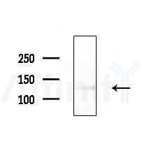 KIF4B Antibody - Western blot analysis of extracts from MDA-MB-231 cells(heat-shock,45min treatment), using KIF4B Antibody at 1/1000 dilution.