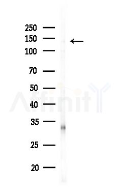 KIF4B Antibody - Western blot analysis of lysates from MDA-MB-231 cells(heat-shock,45min treatment), using KIF4B Antibody at 1/1000 dilution.