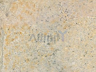 CKLF7 Antibody - DF9388 at 1/100 staining human normal tonsil tissue by IHC-P.