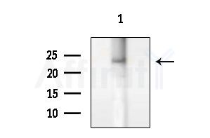 CKLF8 Antibody - Western blot analysis of extracts from HUVEC cells, using CKLF8 Antibody at 1/1000 dilution.