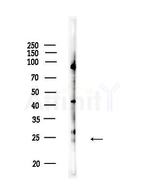 CKLF8 Antibody - Western blot analysis of lysates from HUVEC cells, using CKLF8 Antibody at 1/1000 dilution.