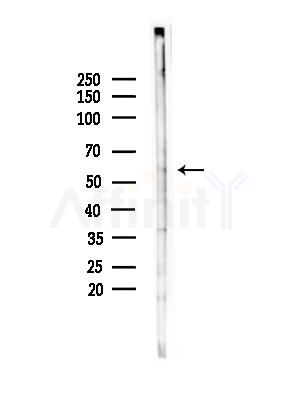 CPSF6 Antibody - Western blot analysis of lysates from COLO205 cells(heat-shock,45min treatment), using CPSF6 Antibody at 1/1000 dilution.