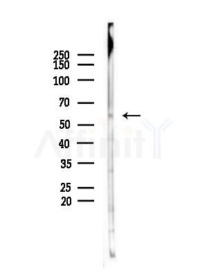 CPSF6 Antibody - Western blot analysis of lysates from A375 cells(starvation,24h treatment), using CPSF6 Antibody at 1/1000 dilution.