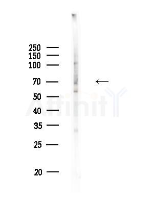 F13B Antibody - Western blot analysis of lysates from HUVEC cells, using F13B Antibody at 1/1000 dilution.